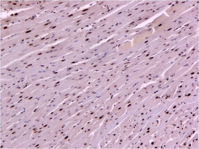 TUNEL染色—心肌