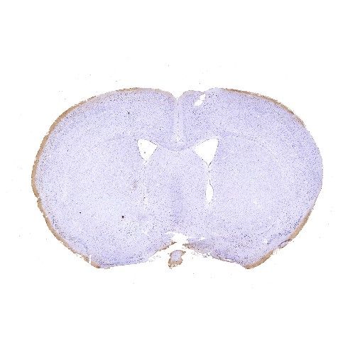 鼠腦普魯士藍(lán)染色