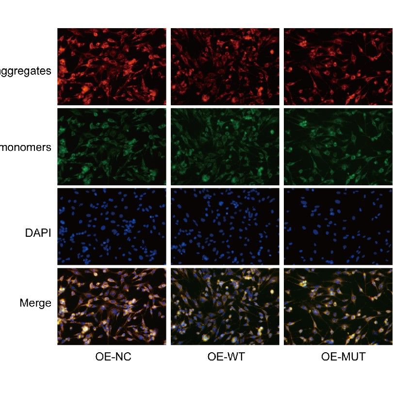 細(xì)胞活性氧檢測