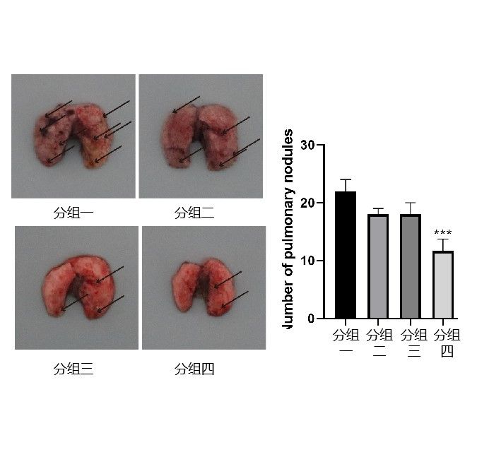 肺轉(zhuǎn)移模型