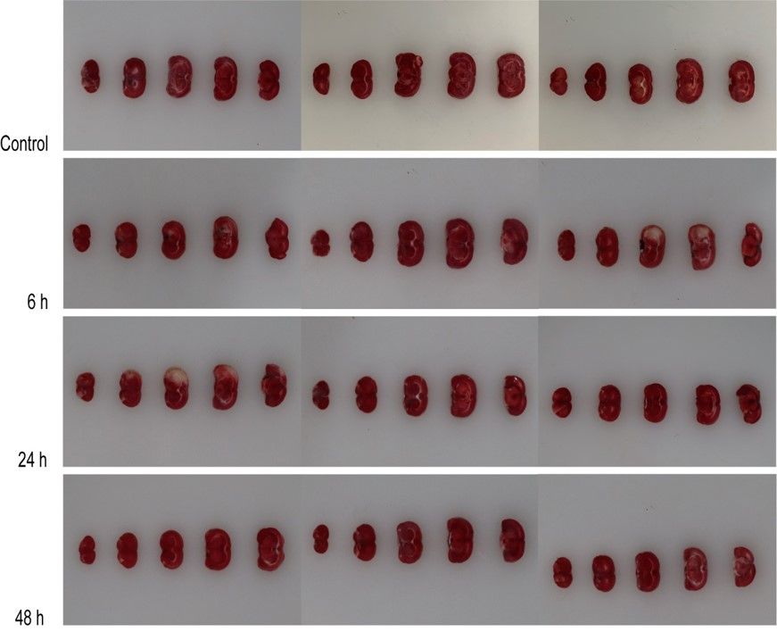 心臟缺血再灌注-TTC染色