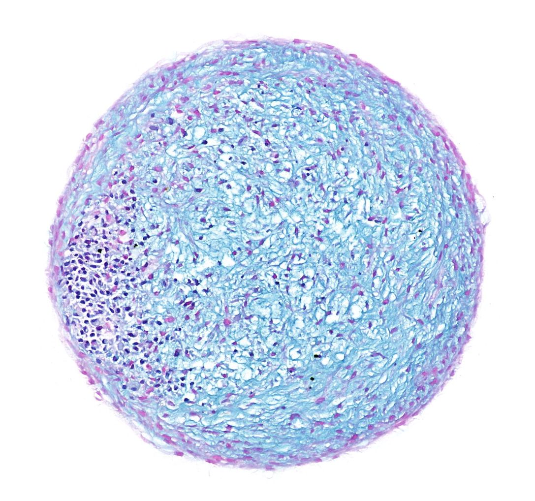 甲苯胺藍(lán)染色