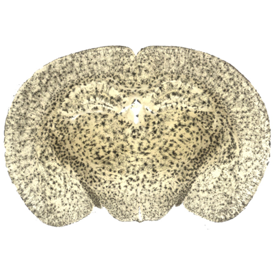 鼠腦高爾基染色